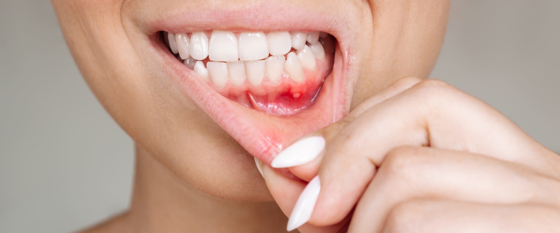 The Hidden Dangers of Gum Disease and Its Impact on Overall Health