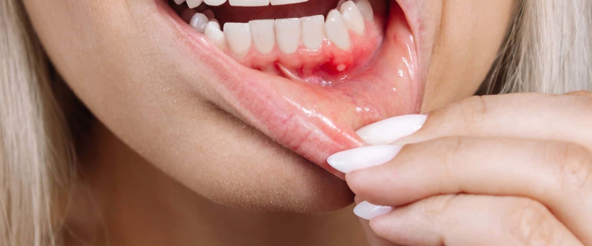 The Truth About Smoking and Gum Disease: How to Reverse the Damage