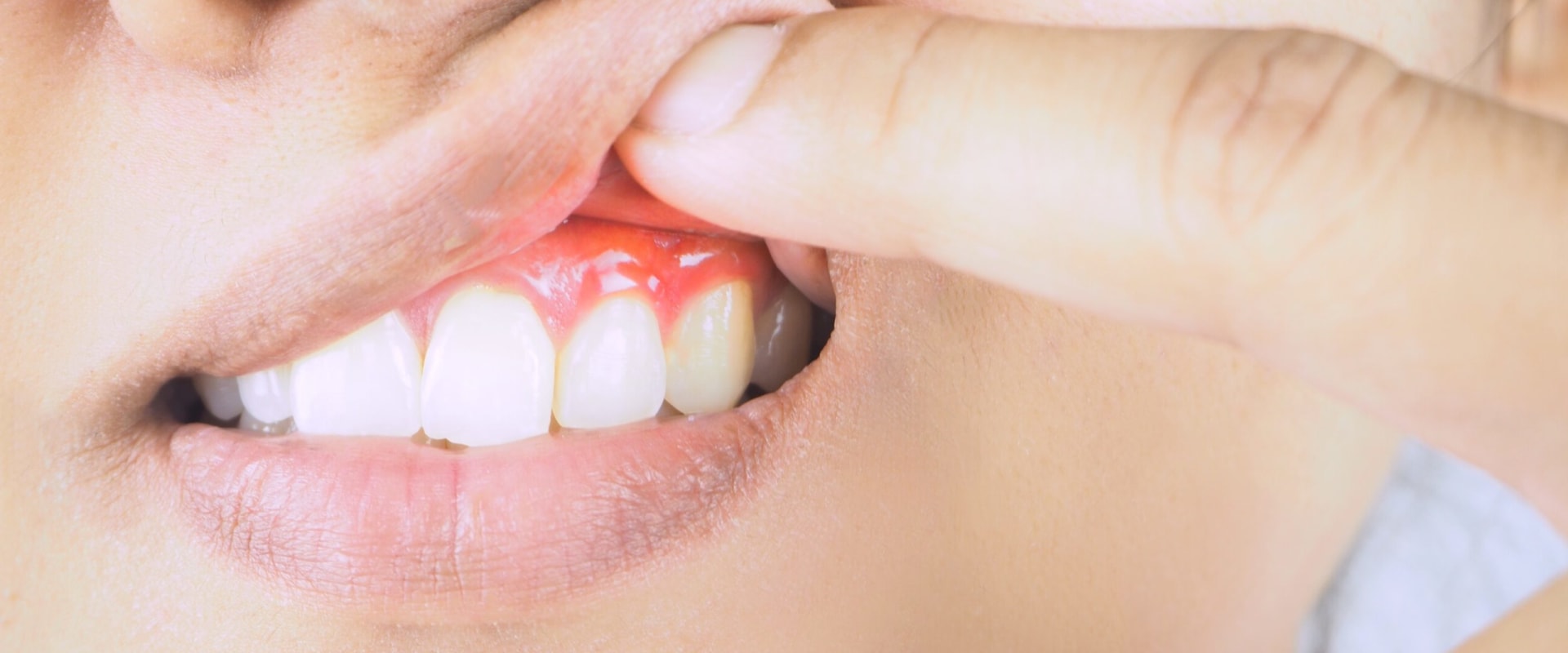 The Importance of Flossing for Reversing Gum Disease: An Expert's Perspective