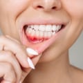 The Hidden Dangers of Gum Disease and Its Impact on Overall Health
