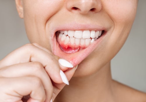 The Hidden Dangers of Gum Disease and Its Impact on Overall Health