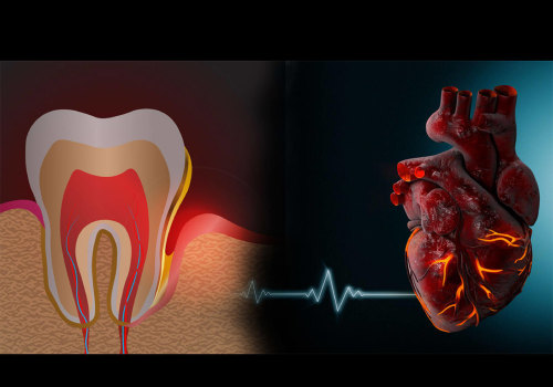The Surprising Connection Between Heart Health and Reversing Gum Disease: An Expert's Perspective